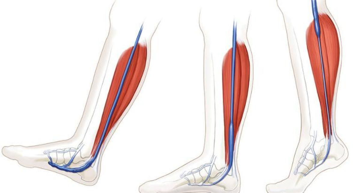 Modern Treatment for Arterial Disease(圖1)