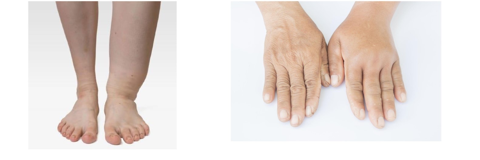 Modern Treatment for Arterial Disease(圖22)