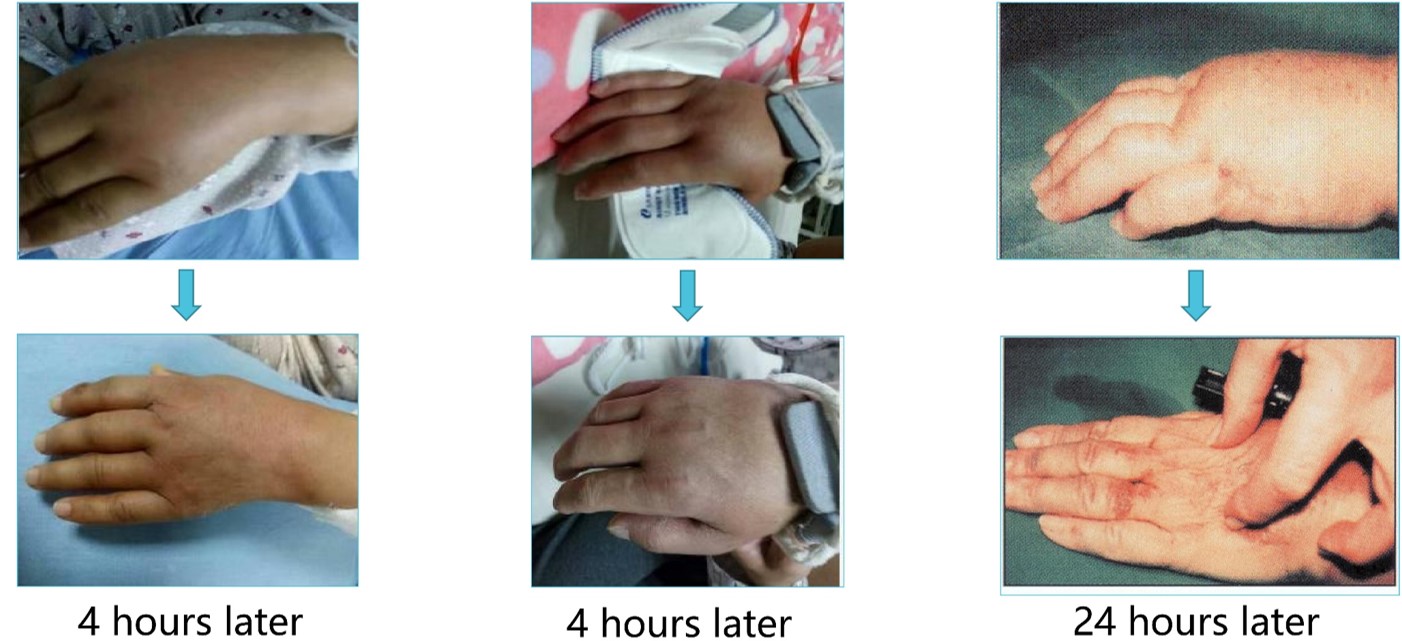 Modern Treatment for Arterial Disease(圖28)