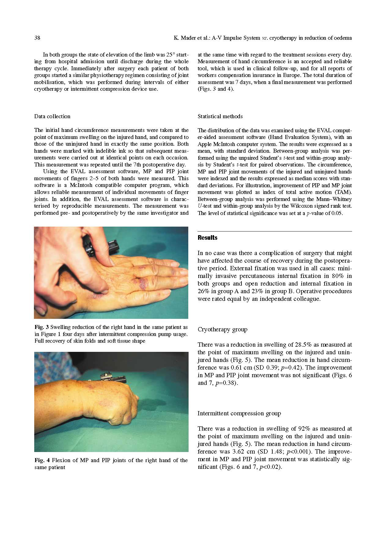 Efficacy of the A-V Impulse ...(圖3)