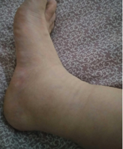 Poor Venous Return(圖1)